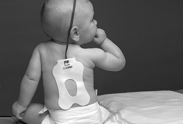 Conmed ECG Backpads and Strippers – Radiolucent – Sold as 25/bx – for Monitoring and Diagnostic ECG