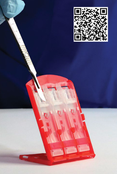 QLICKSMART BladeCASSETTE Blade Remover – Packaged 100 to a box – Sterile and Single-Use – OEM Supply