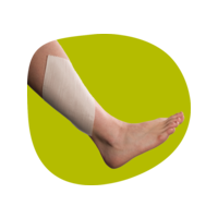 Smith & Nephew PROFORE Multi-Layer Compression Bandage System – Single Configuration – Sold as 8/cs