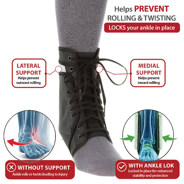 Core Products Swede-O Ankle Lok Brace – 13 Configurations – Sizes X Small to X Large – OEM Supply