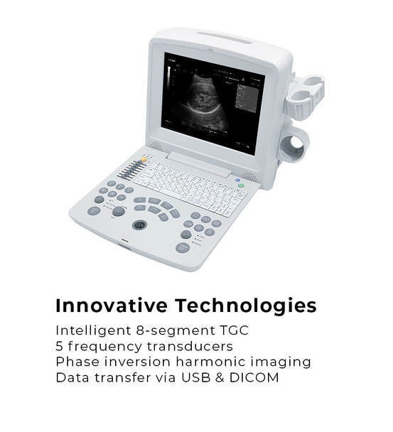 Edan DUS60 Diagnostic Ultrasound System – Black and White, Professional Diagnostic Equipment