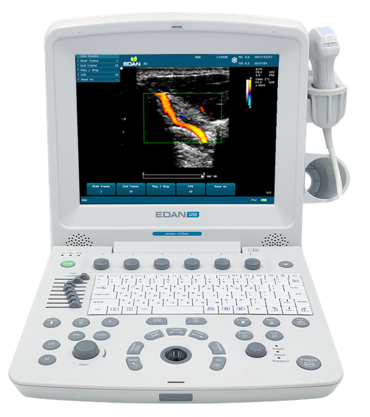 Edan U50 Diagnostic Ultrasound System – Ultrasound System, Professional Diagnostic Equipment