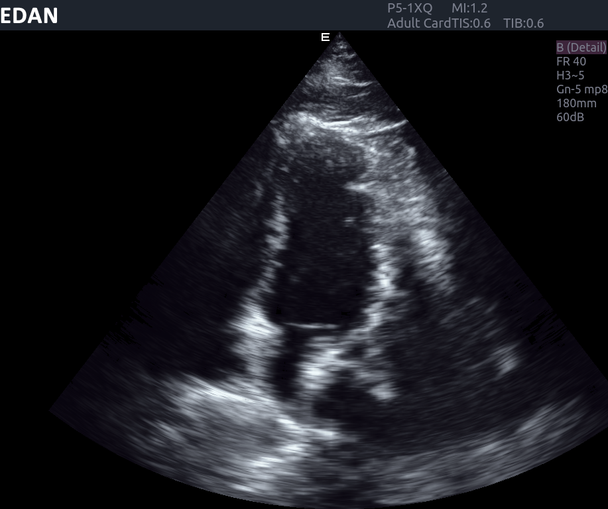 Edan Acclarix AX8 Diagnostic Ultrasound System – Acclarix AX8 Diagnostic Ultrasound System