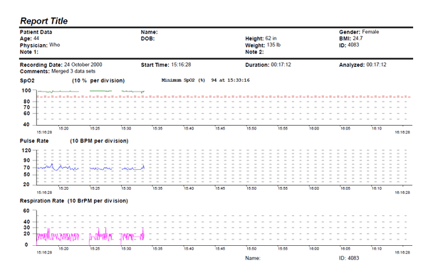 Nonin nVISION Data Management Software for Oximetry Data Download, Review and Reporting, 116081-001
