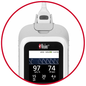 Masimo Rad-G Rugged Handheld Pulse Oximeter with Reusable Sensor for Adult, Pediatric and Infant Patients