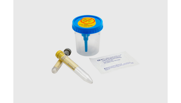 BD Vacutainer Urine Complete Cup Kit – 2-Tube, Conventional Stopper, No Additive, 16 X 100 mm Tubes