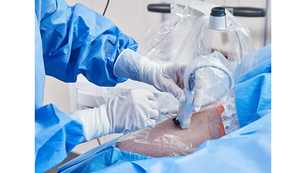 BD Site-Rite Needle Guide Kit – 48 in Probe Cover, 18 g, Multiple Depths for Ultrasound Guidance