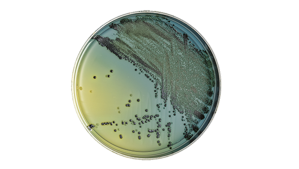 BD BBL Hektoen Enteric Agar Plate – Moderately Selective Medium, 100 Plates per Pack, 84-Day Shelf Life