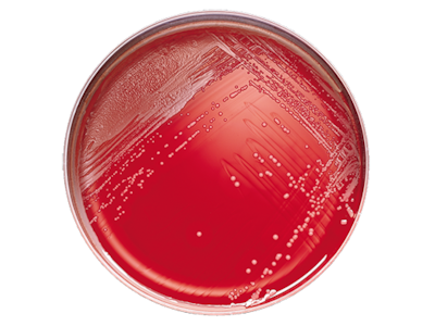 BD BBL Phenylethyl Alcohol Agar with 5% Sheep Blood Plate – 20 Plates, 84-Day Shelf Life, Prepared Culture