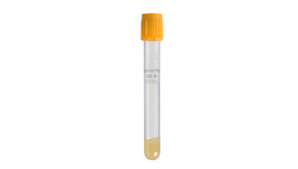 BD Vacutainer SST Tubes – 13x100 Mm, 5 mL Draw Volume, Clot Activator/polymer Gel, BD Hemogard Closure