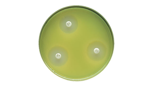 BD BBL Mueller Hinton II Agar 150mm Plate – 24 Pack, Controlled Thymine and Thymidine Levels
