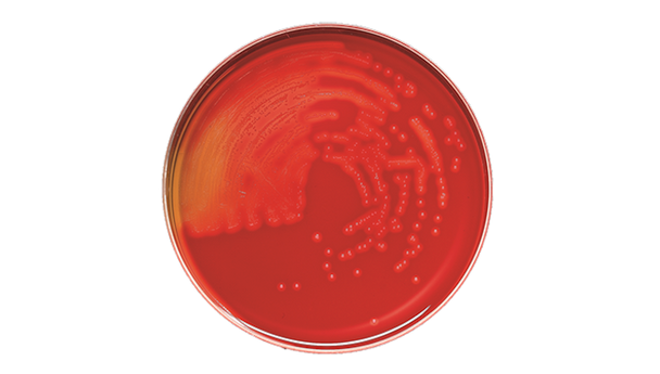 BD BBL Trypticase Soy Agar with 5% Sheep Blood Plate – 100 Plates, 105-Day Shelf Life, Prepared Culture Media