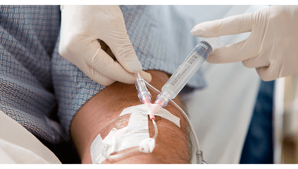 BD Nexiva Closed IV Catheter System – Dual Port, BD Q-Syte Needle-Free Connector, 18 g X 1.75 in