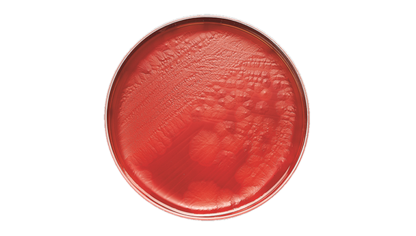 BD BBL CDC Anaerobe 5% Sheep Blood Agar Plate – 100 Plates, 70-Day Shelf Life, Prepared Culture Media