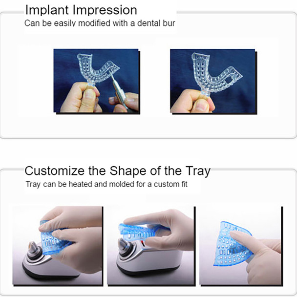 Dukal Impression Perforated Impression Trays – Anterior Lower, Pink, 12/BG, 10 BGs/CS, 3.8 lb