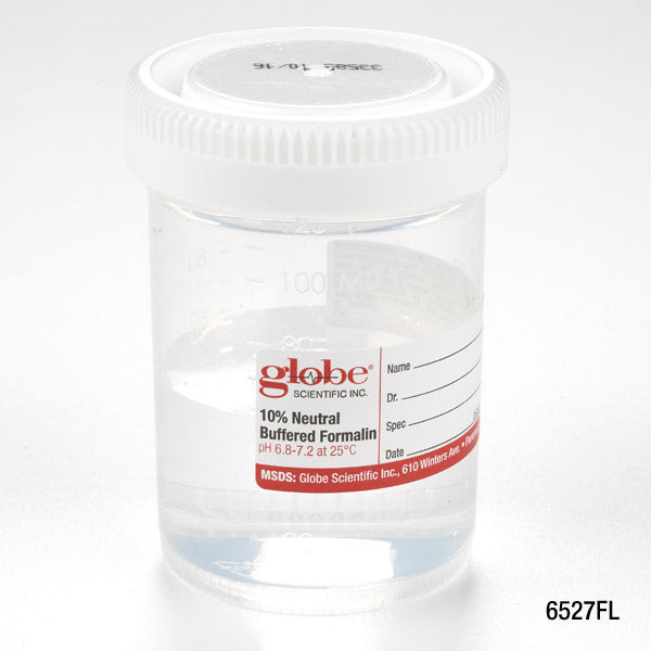 Globe Pre-Filled Container: 120mL – 4oz, 96 per case, Filled with 60ml of 10% Neutral Buffered Formalin