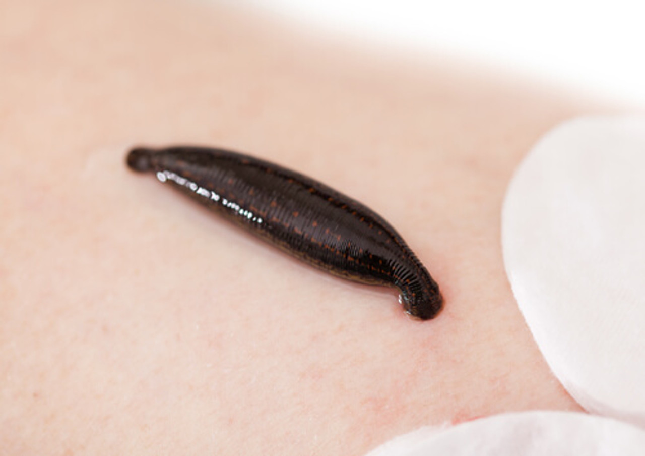 How to Rid the Pond of Leeches: Effective & Safe Solutions