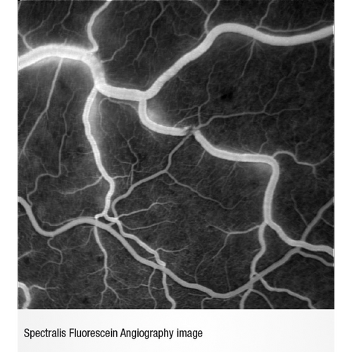 Heidelberg Spectralis Fluorescein Angiography Module