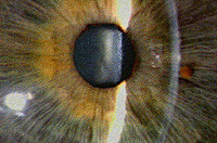 Haag-Streit Techniques in Biomicroscopy