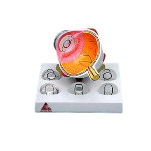Gulden Eye Model - IOL
