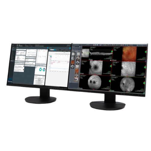 Heidelber Eye Explorer - HEYEX 2