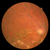 NIDEK AFC-330 Non-Mydriatic Auto Fundus Camera