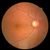 NIDEK AFC-330 Non-Mydriatic Auto Fundus Camera