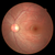 NIDEK AFC-330 Non-Mydriatic Auto Fundus Camera