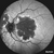 Heidelberg Spectralis - Widefield 55-degree Fundus & OCT Module