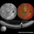 Heidelberg Spectralis - Widefield 55-degree Fundus & OCT Module