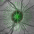 Heidelberg Spectralis Glaucoma Module Premium Edition