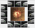 Heidelberg Spectralis Glaucoma Module Premium Edition