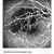 Heidelberg Spectralis Fluorescein Angiography Module