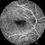 Heidelberg Spectralis Widefield Imaging Module