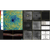 Optical Coherence Tomography / Fundus Camera Retina Scan Duo™2 Angio scan