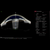 Heidelberg Anterion Metrics App