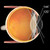 Volk QuadrAspheric Laser Lens