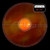 Volk 15D Aspheric Lens
