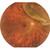 Reticam 3100 Plus Ultra-Widefield Fundus Camera