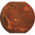 Reticam 3100 Plus Ultra-Widefield Fundus Camera