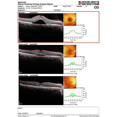 Heidelberg Spectralis OCT UI Screen