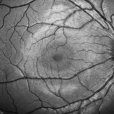 Heidelberg Spectralis OCT UI Screen