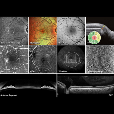 Heidelberg Spectralis OCT UI Screen