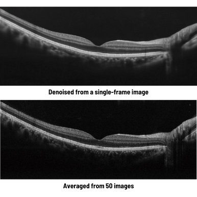 Optical Coherence Tomography / Fundus Camera Retina Scan Duo™2 Denoising using deep learning