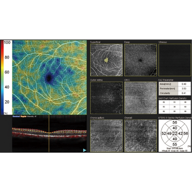 Optical Coherence Tomography / Fundus Camera Retina Scan Duo™2 Angio scan