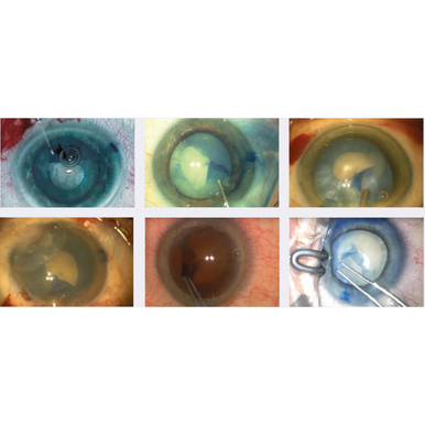 DORC VisionBlue – INNOVA