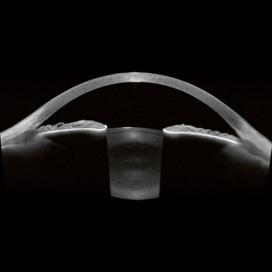 Carte de la plateforme d'imagerie multimodale Heidelberg Anterion