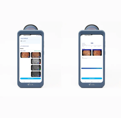 Volk VIVAᵀᴹ Portable fundus camera