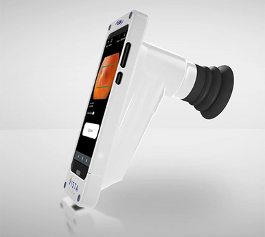 Volk VistaView® Portable Fondus Camera – INNOVA