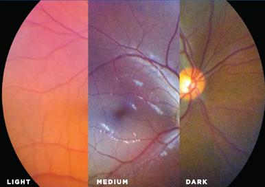 Caméra Volk VistaView® Fondus